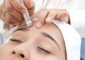 Cum să eliminați ridurile de pe frunte folosind remedii casnice și profesionale moderne